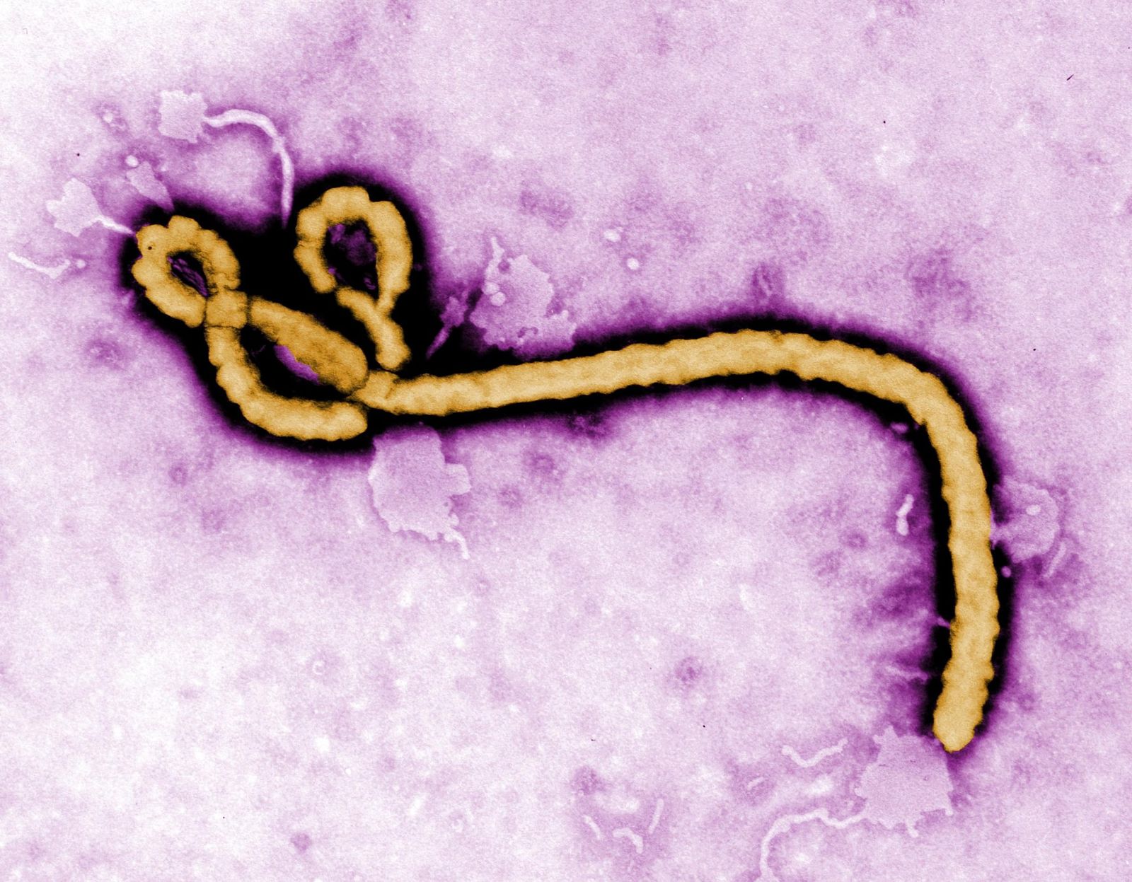 A colourised electron micrograph of a single long, looped thread-like Ebola virus particle against a purple background.